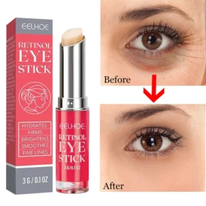 Creme para os olhos anti Rugas com Retinol, remove as olheiras, clareia, hidrata, ilumina e cuida da pele.