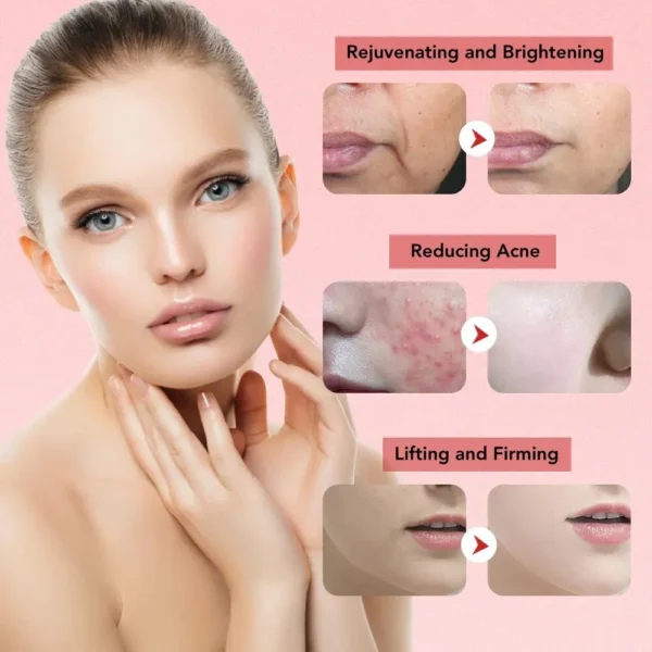 Massageador Removedor de Rugas, Anti Envelhecimento Facial Poderoso Reparador para Rejuvenescimento e Beleza da Pele. Dispositivo, 7 em 1 RF e EMS Micro Levantamento LED vibração no Rosto. - Image 5